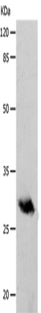 Western Blot analysis of Human fetal brain tissue using POMC Polyclonal Antibody at dilution of 1:400