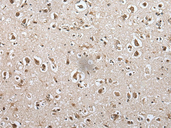 Immunohistochemistry of paraffin-embedded Human brain tissue  using METAP1D Polyclonal Antibody at dilution of 1:60(?200)