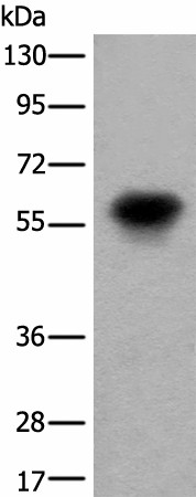 Western blot analysis of Human fetal brain tissue lysate  using CDT1 Polyclonal Antibody at dilution of 1:550