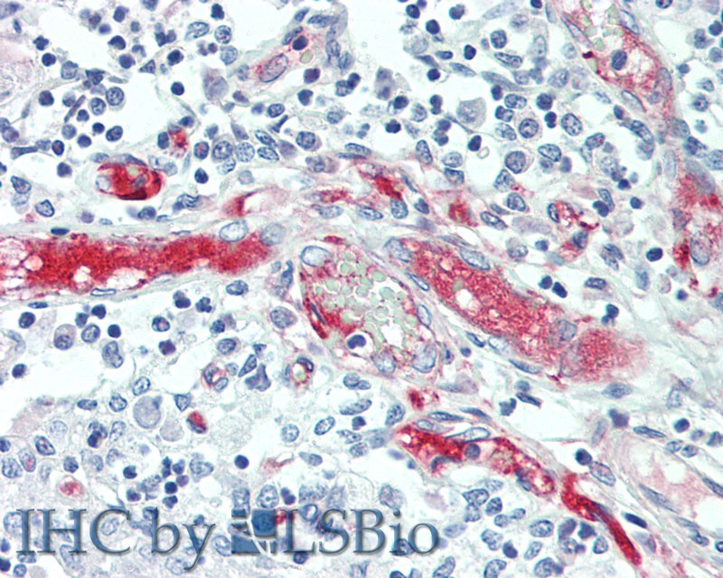 Immunohistochemistry of paraffin-embedded Thymus tissue using APOL1 Polyclonal Antibody at dilution of 1:100(Elabscience Product Detected by Lifespan).