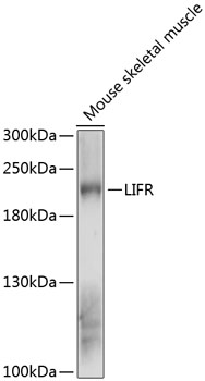 Western blot analysis of extracts of mouse skeletal muscle using LIFR Polyclonal Antibody at 1:3000 dilution.