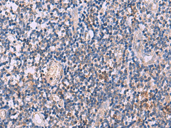 Immunohistochemistry of paraffin-embedded Human tonsil tissue  using IL4R Polyclonal Antibody at dilution of 1:45(?200)