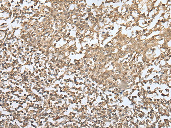 Immunohistochemistry of paraffin-embedded Human tonsil tissue  using ZKSCAN1 Polyclonal Antibody at dilution of 1:30(?200)