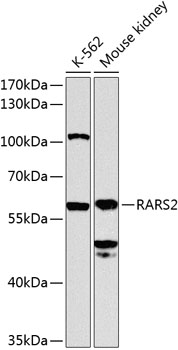 Western blot analysis of extracts of various cell lines using RARS2 Polyclonal Antibody at 1:1000 dilution.