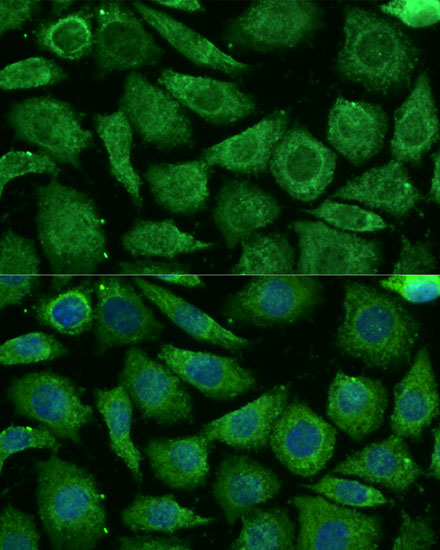 Immunofluorescence analysis of L929 cells using NDUFB3 Polyclonal Antibody at dilution of  1:100 (40x lens). Blue: DAPI for nuclear staining.