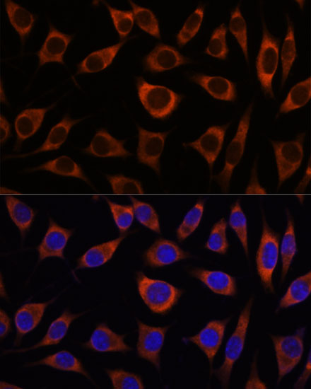 Immunofluorescence analysis of L929 cells using CTNNA3 Polyclonal Antibody at dilution of  1:100. Blue: DAPI for nuclear staining.