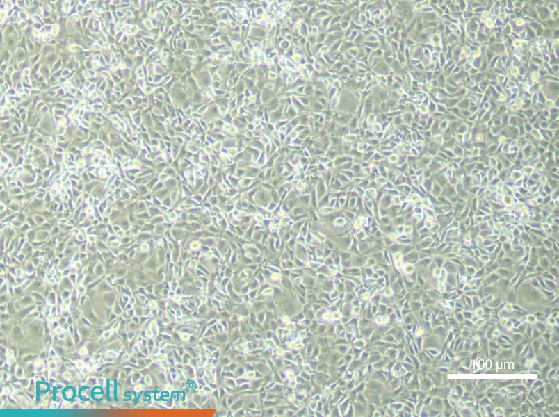 Rat Brain Microvascular Endothelial (Primary cell immortalization) Cell Complete MediumRat Brain Microvascular Endothelial (Primary cell immortalization) Cell Complete Medium - 2