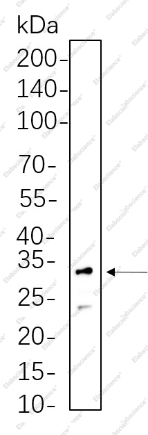 Recombinant RPS6 Monoclonal Antibody - 1