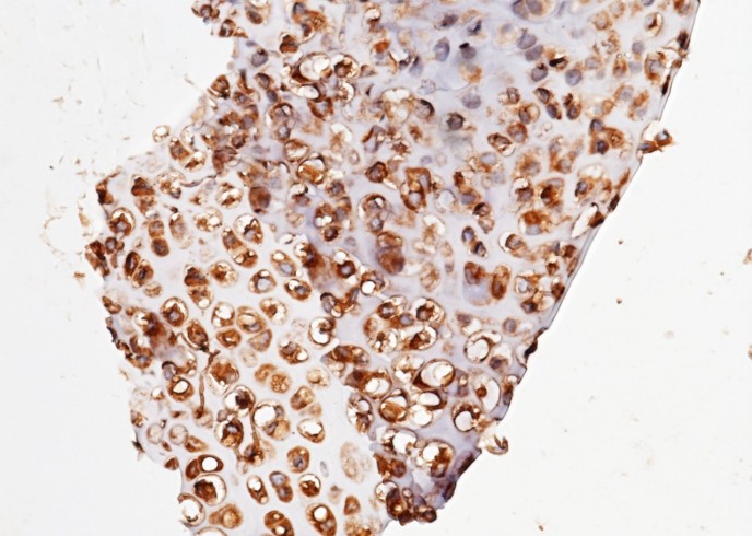 Recombinant UCHL3 Monoclonal Antibody - small - 3