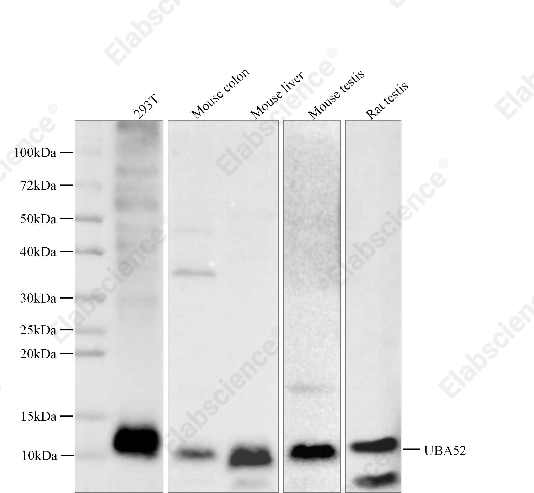 Recombinant UBA52 Monoclonal Antibody - 1