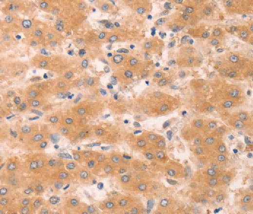 GNA11 Polyclonal Antibody - 2