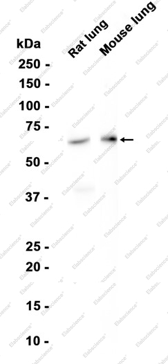Recombinant MMP8 Monoclonal Antibody - 1