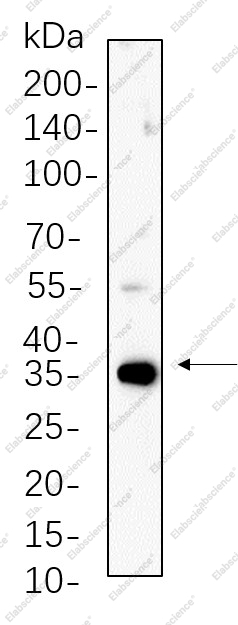 Recombinant PP1α/β Monoclonal Antibody - 1