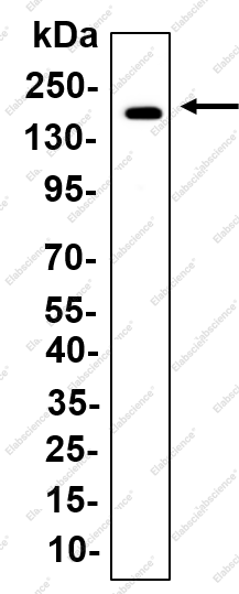 Recombinant NMDAR2B Monoclonal Antibody - 1