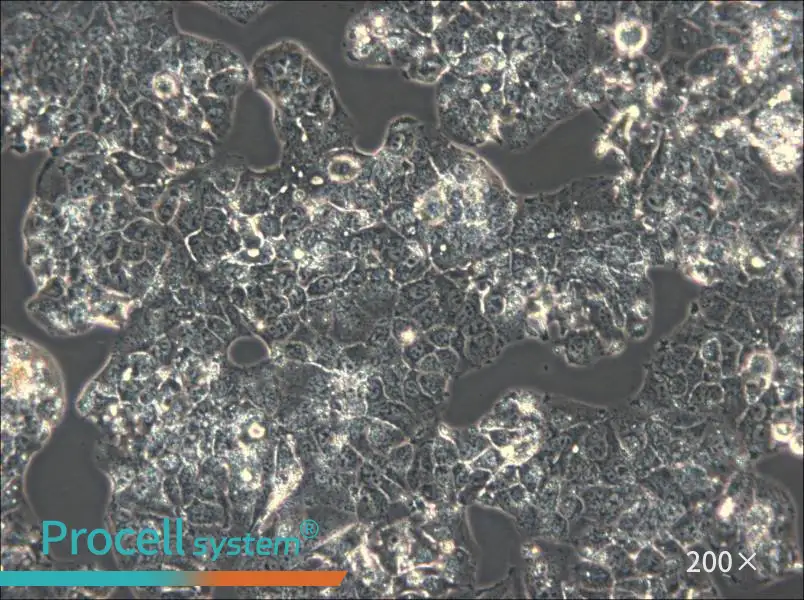 HuH-1 Cell Complete Medium - 5