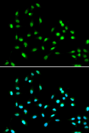 Immunofluorescence analysis of A549 cells using SMARCAD1 Polyclonal Antibody Blue: DAPI for nuclear staining.