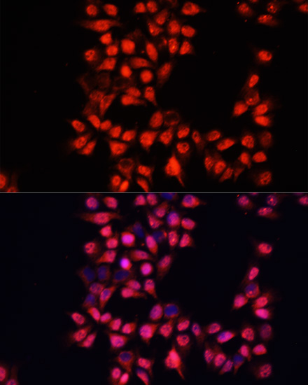 Immunofluorescence analysis of HeLa cells using ADAM10 Polyclonal Antibody at dilution of  1:100. Blue: DAPI for nuclear staining.