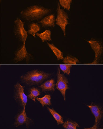 Immunofluorescence analysis of C6 cells using HOOK3 Polyclonal Antibody at dilution of  1:100. Blue: DAPI for nuclear staining.