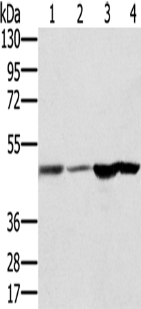 Western Blot analysis of Human fetal brain and normal liver tissue, Human normal kidney tissue and hepg2 cell using RNH1 Polyclonal Antibody at dilution of 1:400