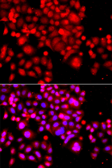 Immunofluorescence analysis of A549 cells using ASCC3 Polyclonal Antibody