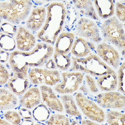 Immunohistochemistry of paraffin-embedded rat kidney using NADPH oxidase 4 Polyclonal Antibody at dilution of 1:100 (40x lens).Perform high pressure antigen retrieval with 10 mM citrate buffer pH 6.0 before commencing with IHC staining protocol.