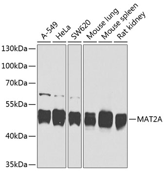 Western blot analysis of extracts of various cell lines using MAT2A Polyclonal Antibody at dilution of 1:1000.