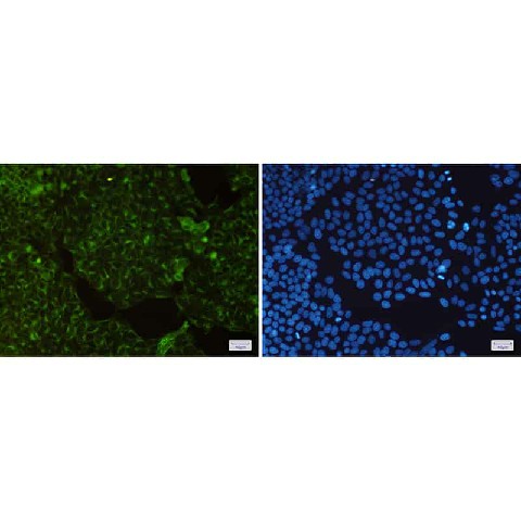 Immunofluorescence of Transferrin Receptor(green) in Hela cells using Transferrin Receptor Rabbit mAb at dilution 1:200, and DAPI(blue)