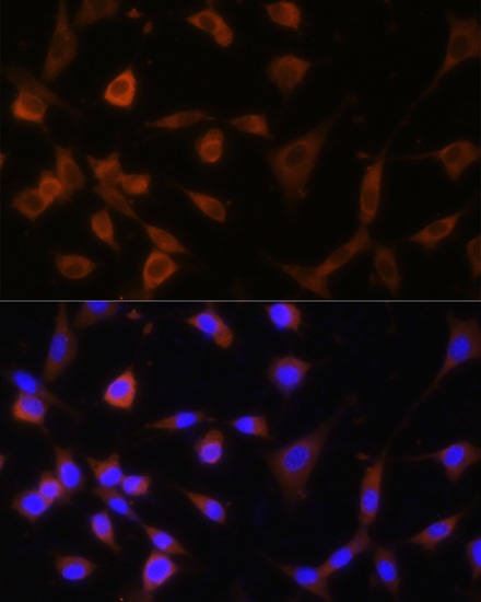 Immunofluorescence analysis of NIH-3T3 cells using GANAB Polyclonal antibody at dilution of 1:100. Blue: DAPI for nuclear staining.