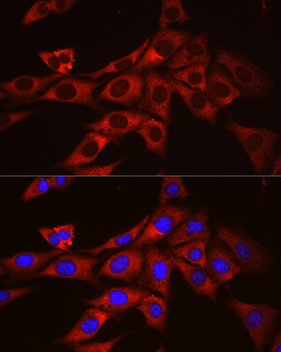 Immunofluorescence analysis of NIH/3T3 cells using ODC1 Polyclonal Antibody at dilution of 1:100 (40x lens). Blue: DAPI for nuclear staining.