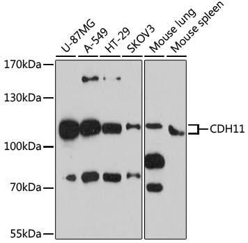 Western blot analysis of extracts of various cell lines using CDH11 Polyclonal Antibody at 1:3000 dilution.