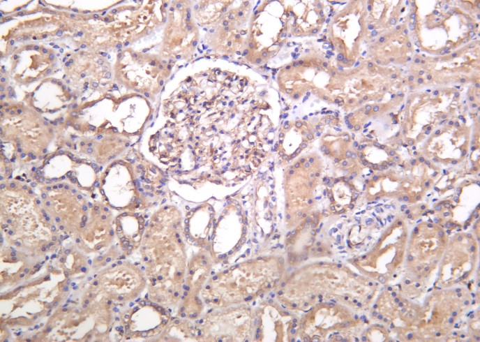 Recombinant MYH9 Monoclonal Antibody-searchlist-1
