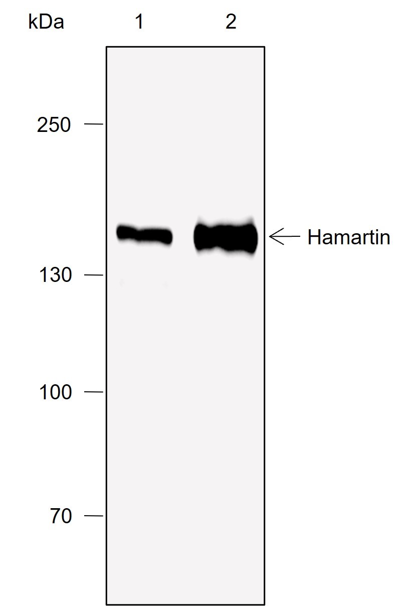 Recombinant Hamartin Monoclonal Antibody-searchlist-1