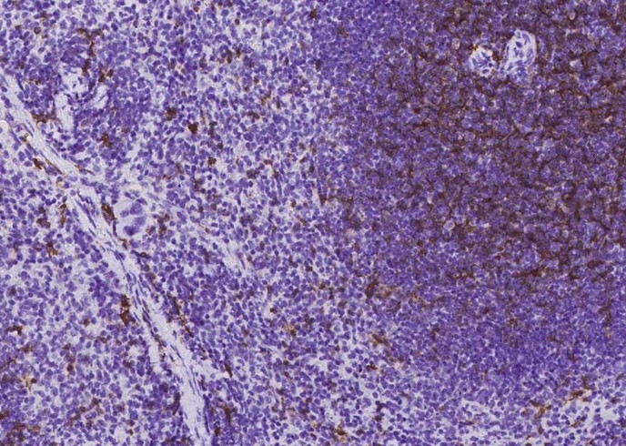 Recombinant CD8 alpha/CD8A Monoclonal Antibody-searchlist-1