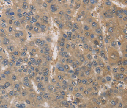 DPYSL3 Polyclonal Antibody - 2