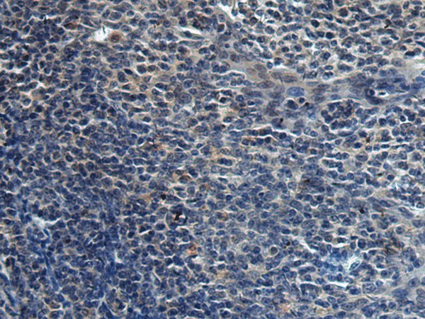 Immunohistochemistry of paraffin-embedded Human tonsil tissue  using HAUS6 Polyclonal Antibody at dilution of 1:45(?200)