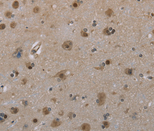 Immunohistochemistry of paraffin-embedded Human brain  tissue using MGLL Polyclonal Antibody at dilution 1:40