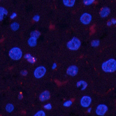 Immunofluorescence analysis of Rat liver tissue using Phospho-Pan-Akt (Ser473) Polyclonal Antibody at dilution of 1:200