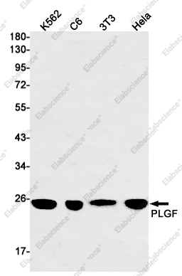 Recombinant PLGF Monoclonal Antibody - 1