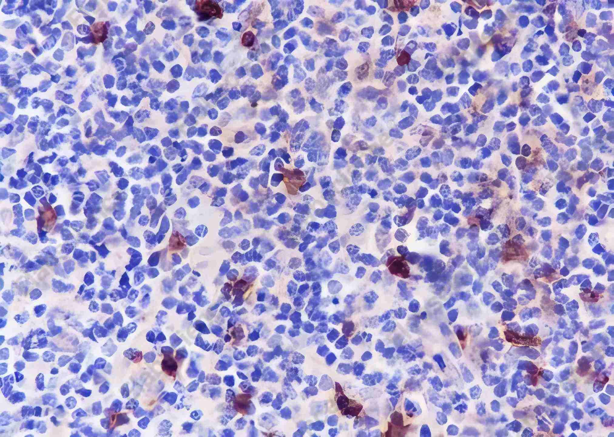 Recombinant CD134/OX40 Monoclonal Antibody - 2