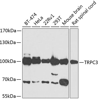 Western blot analysis of extracts of various cell lines using TRPC3 Polyclonal Antibody at 1:500 dilution.