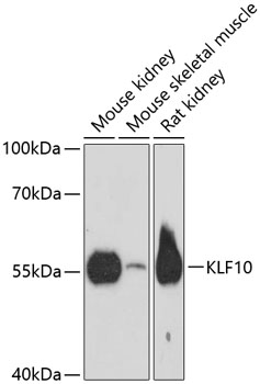 Western blot analysis of extracts of various cell lines using KLF10 Polyclonal Antibody at dilution of 1:3000.