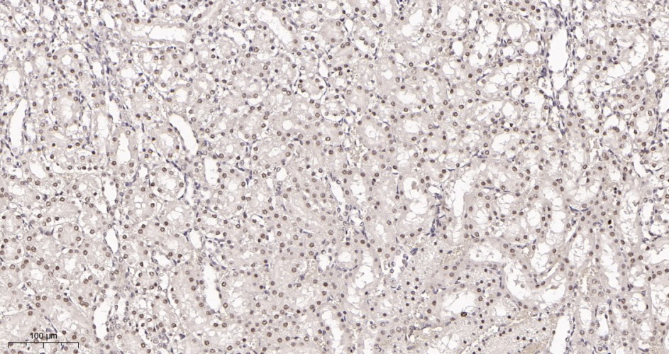 Recombinant Polycomb Protein SUZ12 Monoclonal Antibody - small - 3