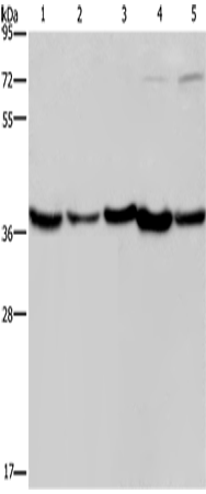 Western Blot analysis of Human fetal liver, Mouse skeletal muscle and heart tissue, Hela and Jurkat cell   using DNAJB4 Polyclonal Antibody at dilution of 1:200