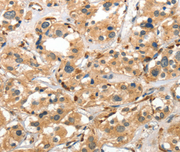 Cathepsin E Polyclonal Antibody - 3