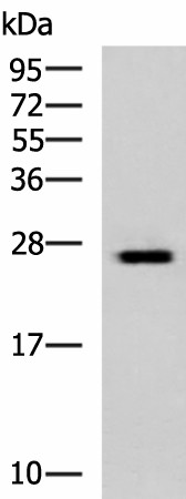 Western blot analysis of Hela cell lysate  using GINS3 Polyclonal Antibody at dilution of 1:800