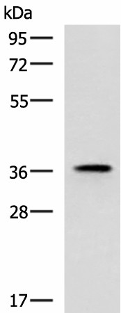 Western blot analysis of Mouse adrenal gland tissue lysate  using USP50 Polyclonal Antibody at dilution of 1:400