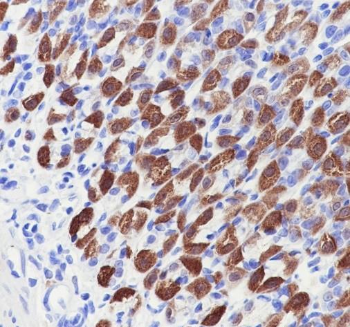 Recombinant Creatine kinase B type Monoclonal Antibody - small - 4