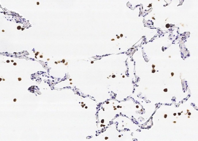 Recombinant CD68 Monoclonal Antibody - small - 1