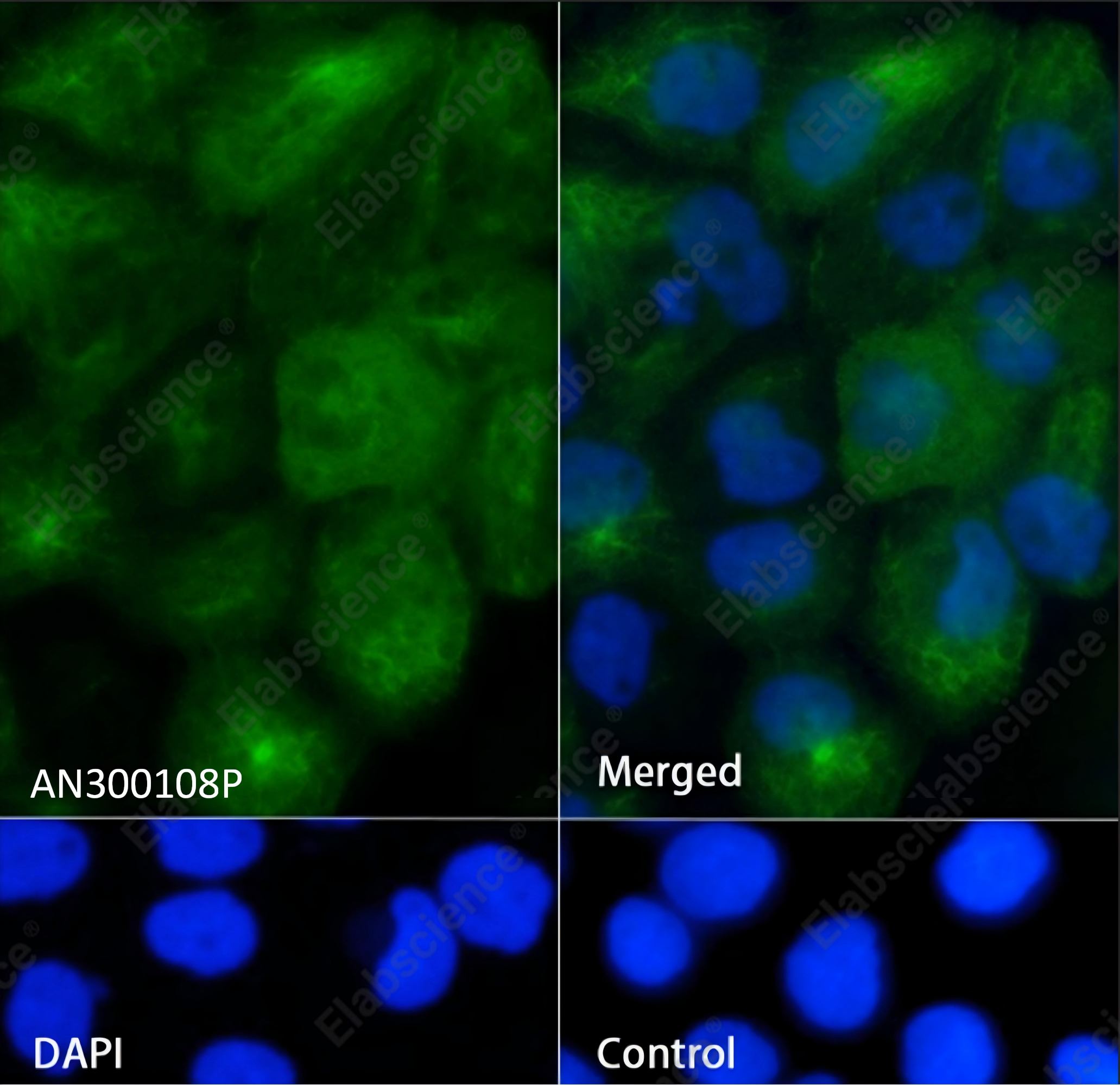 Recombinant Cytokeratin 5/KRT5 Monoclonal Antibody - 4