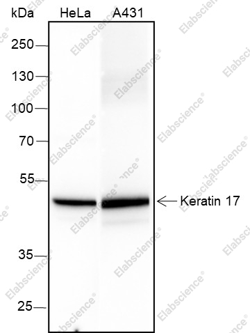 Recombinant Keratin 17 Monoclonal Antibody - 1